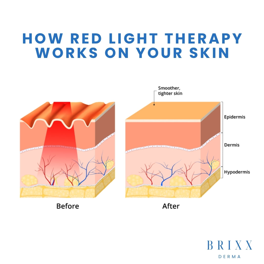 Diagram showing how red light therapy works on skin, labeled 'Before' and 'After', with 'Brixx Derma' branding.