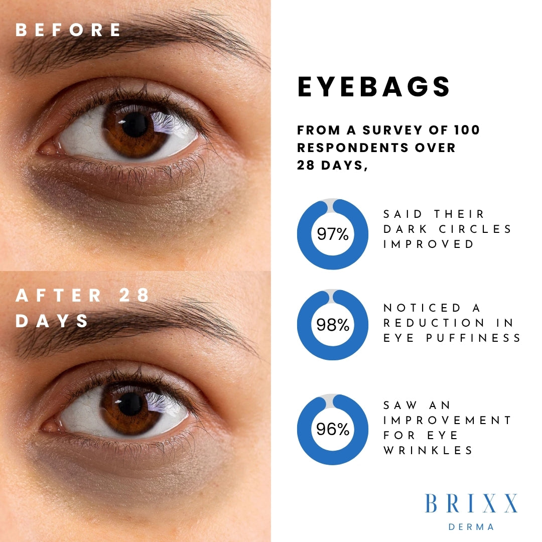 Before and after comparison of eye bags with Brixx Derma improvement statistics.