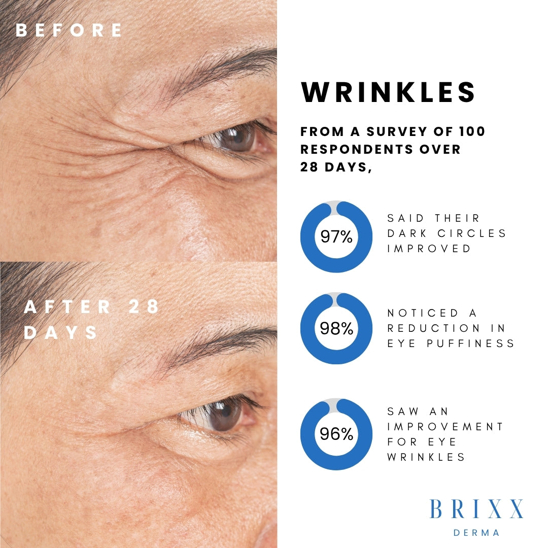 Before and after comparison of eye wrinkles with Brixx Derma product, showing improvement statistics.