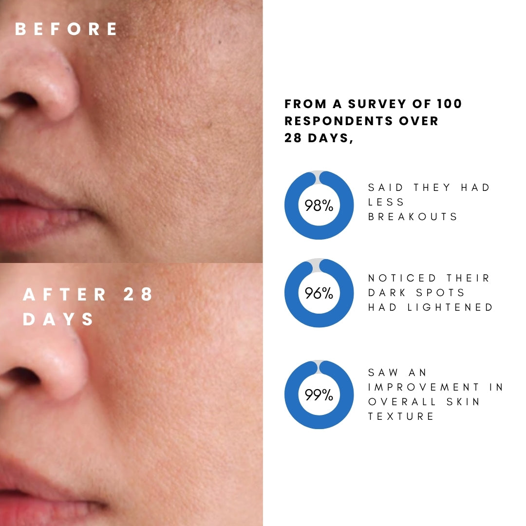 Before and after comparison of skin with survey results on improvement over 28 days.