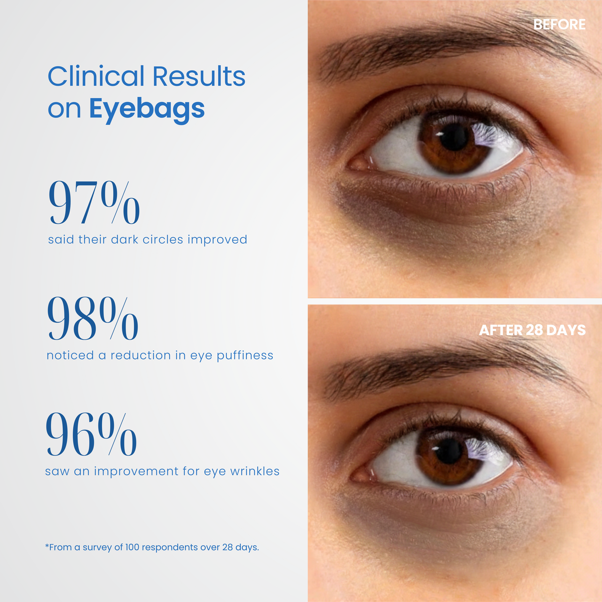 Reviva Eye Pro Therapy Device