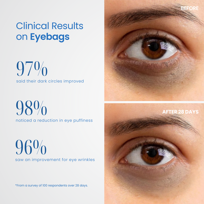 Reviva Eye Pro Therapy Device