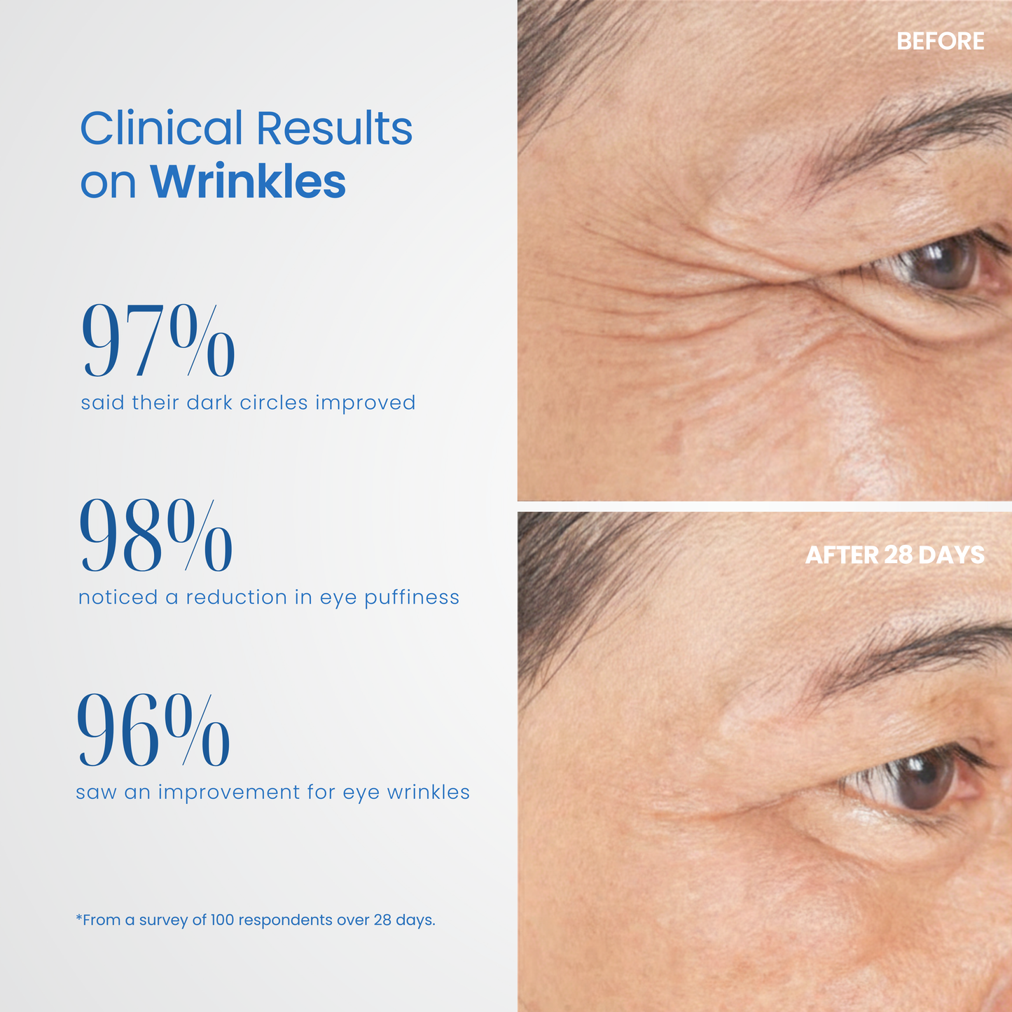 Reviva Eye Pro Therapy Device