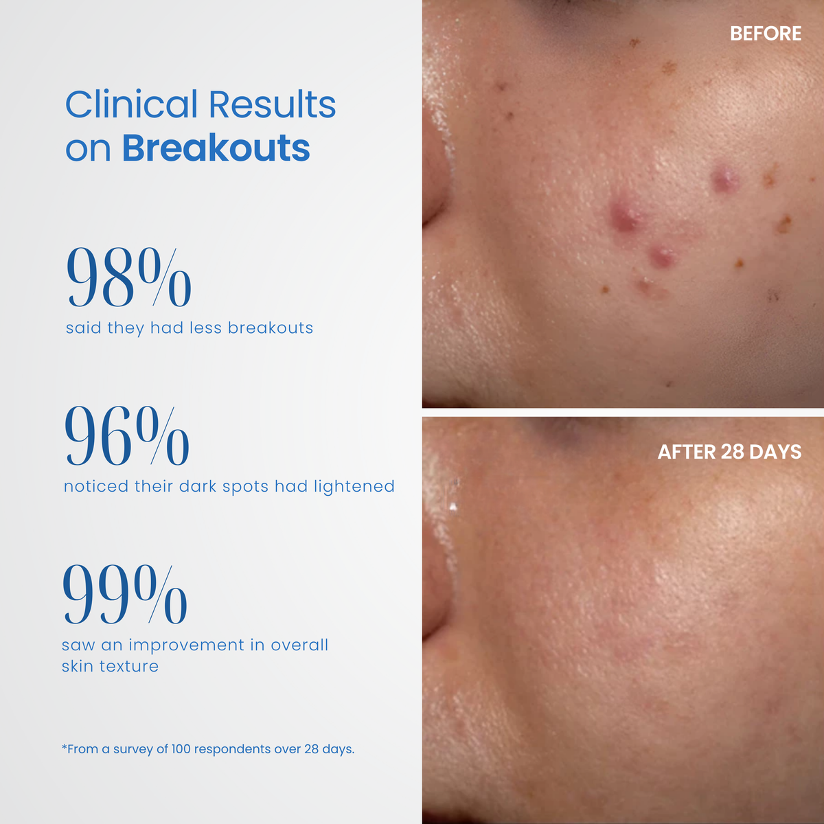 Derma Elite Advanced Skin Rejuvenation Device