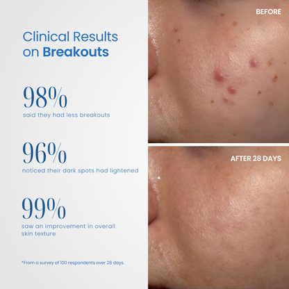 Derma Elite Advanced Skin Rejuvenation Device