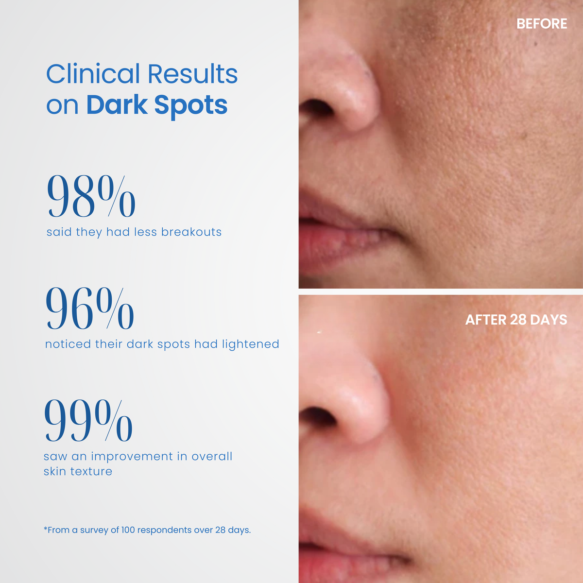 Derma Elite Advanced Skin Rejuvenation Device