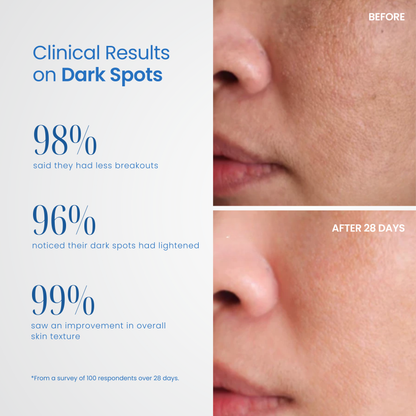 Derma Elite Advanced Skin Rejuvenation Device