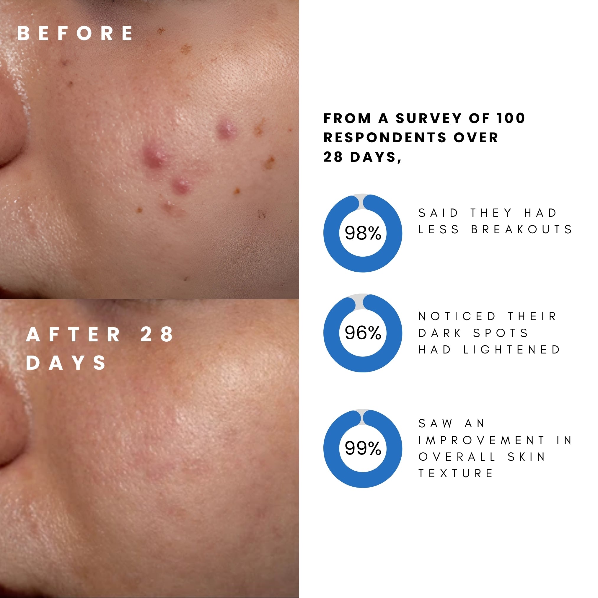 Derma Elite Advanced Skin Regeneration Device