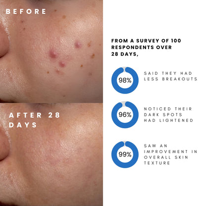 Derma Elite Advanced Skin Regeneration Device
