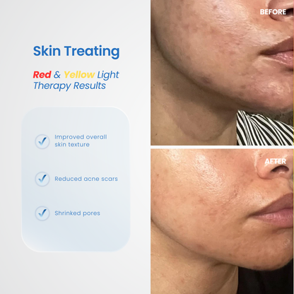 Sculpta-V Lift & Sculpt Device
