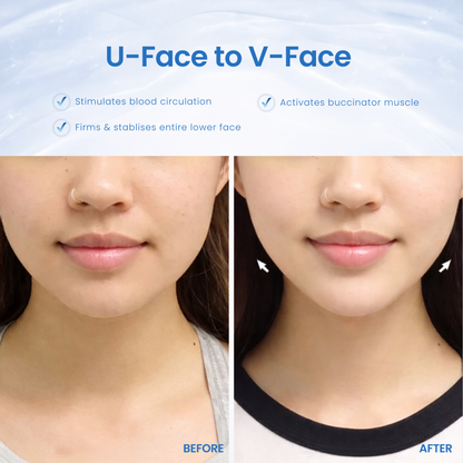 LumiLift Pro Face Lift Device