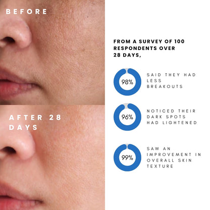 Before and after comparison of skin with survey results on improvement over 28 days.