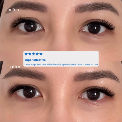 PRE-ORDER: Eye Restoration