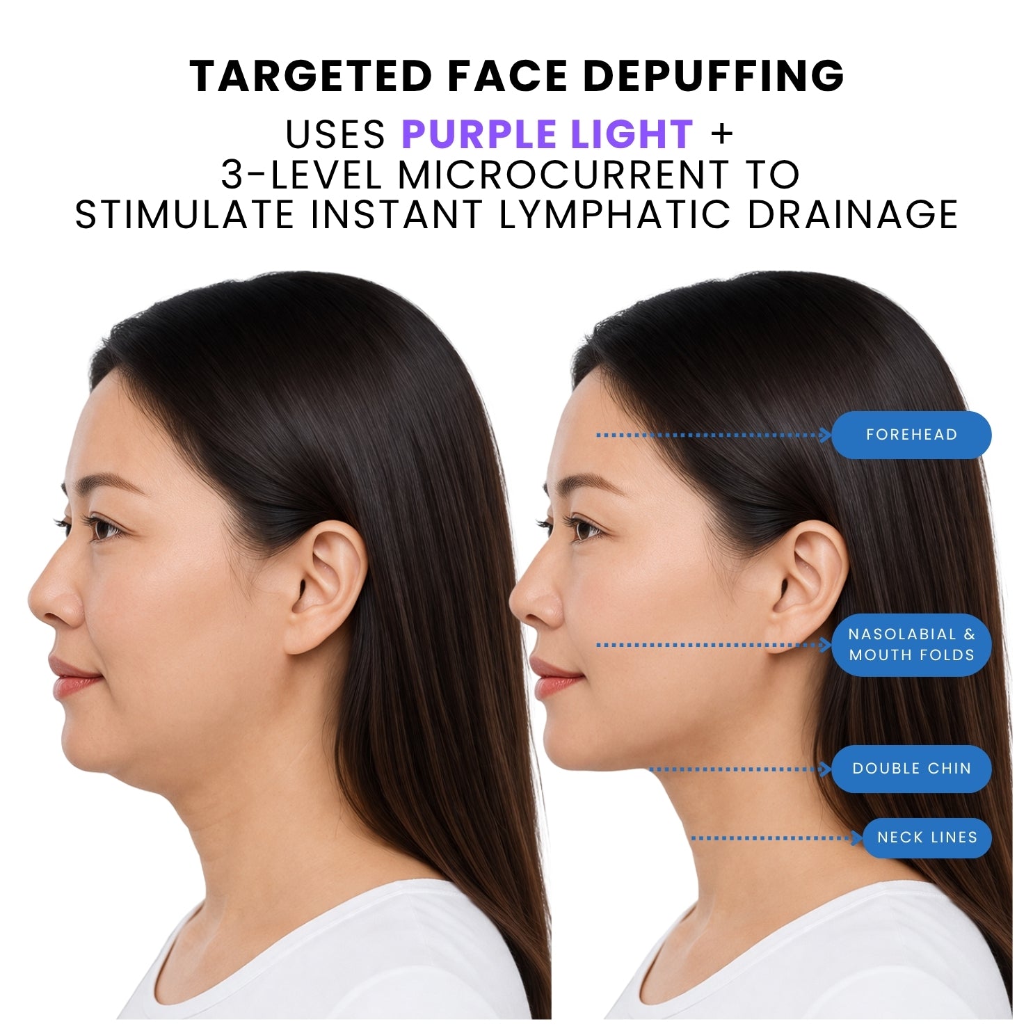 Sculpta-V Lift & Sculpt Device
